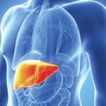 Nonalcoholic Steatohepatitis NASH