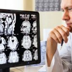 Brain Scans