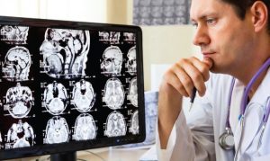 Brain Scans