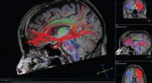 Core Imaging for Neuroscience Studies