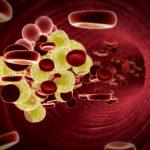 Cholesterol in the blood.jpg