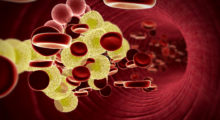 Cholesterol in the blood.jpg