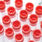 Lab Test Tubes