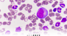 Webinar - Challenges and Considerations in Clinical Development of “Targeted Therapies