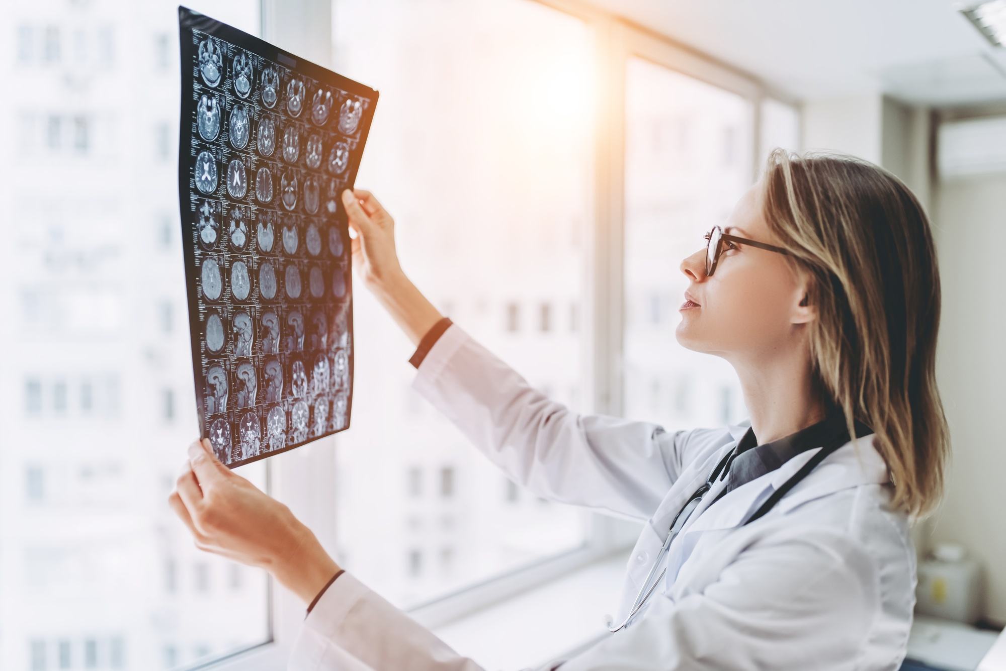 female doctor examining the X-ray