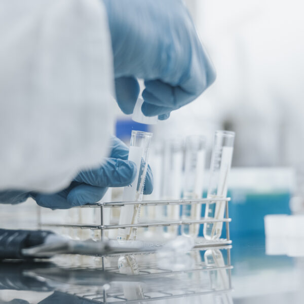 Scientist taking samples in laboratory