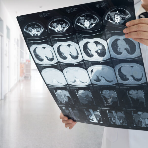 A doctor viewing scans