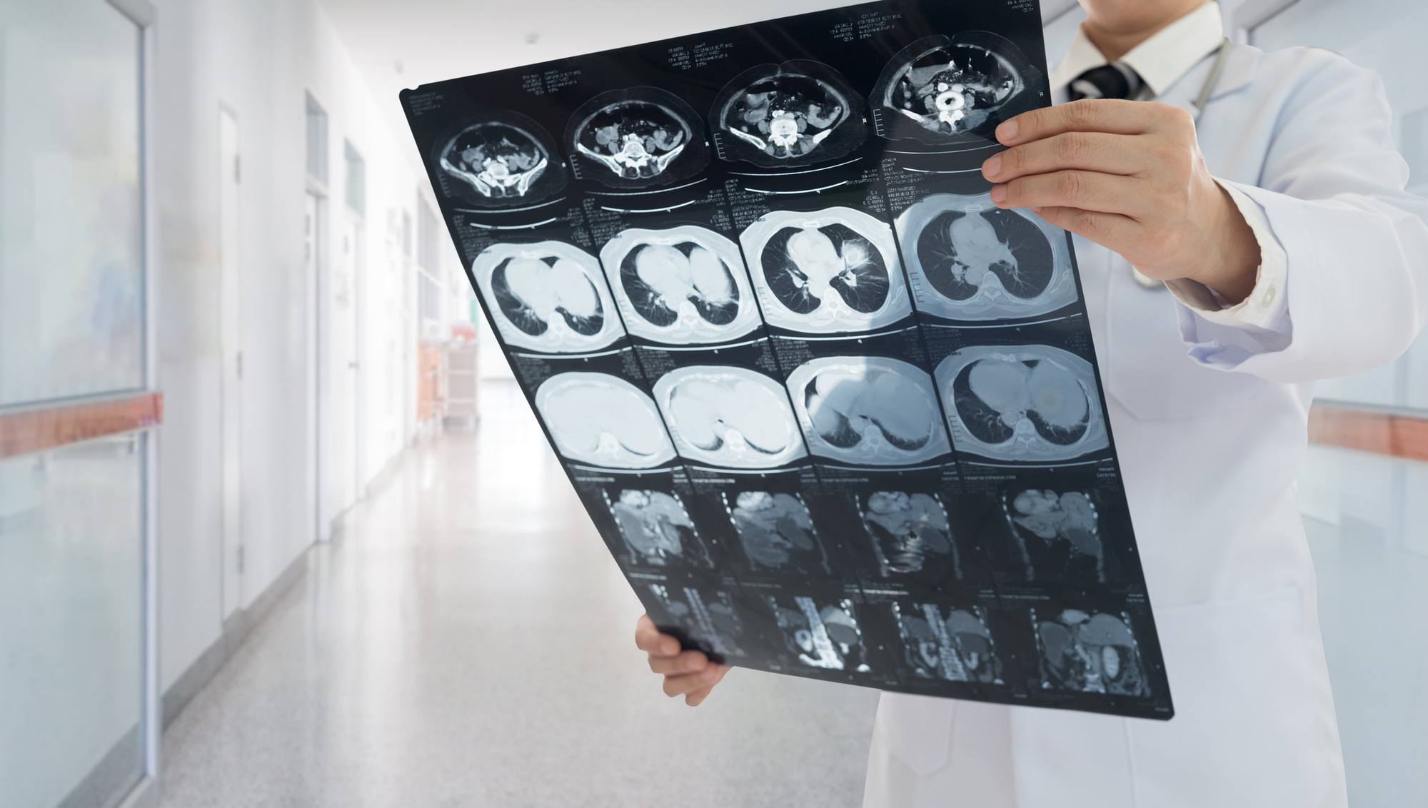 A doctor viewing scans
