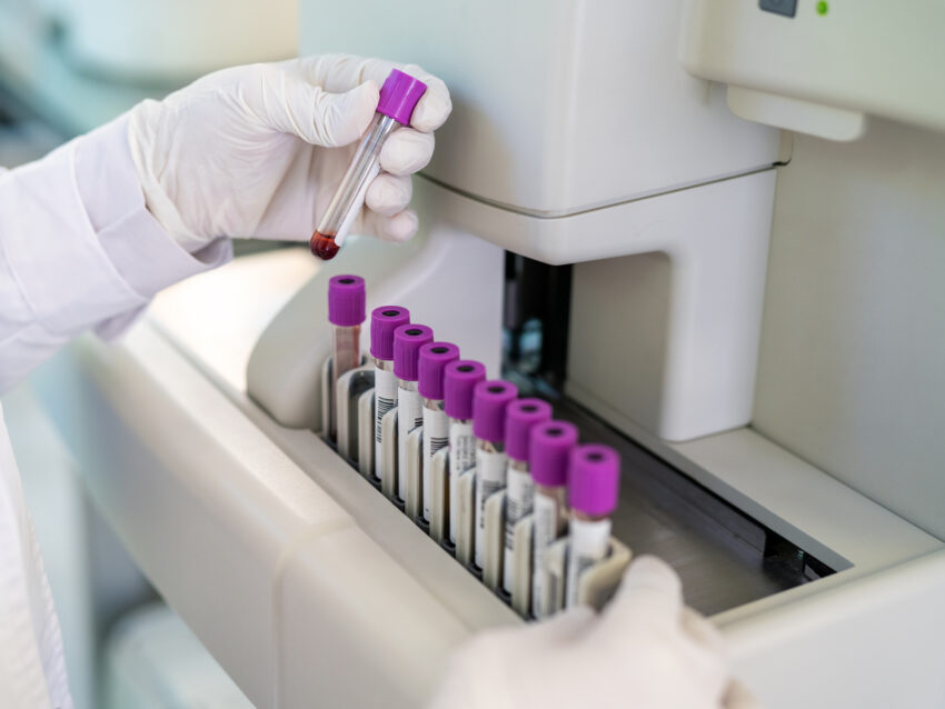 Biomarkers Medpace Central Labs