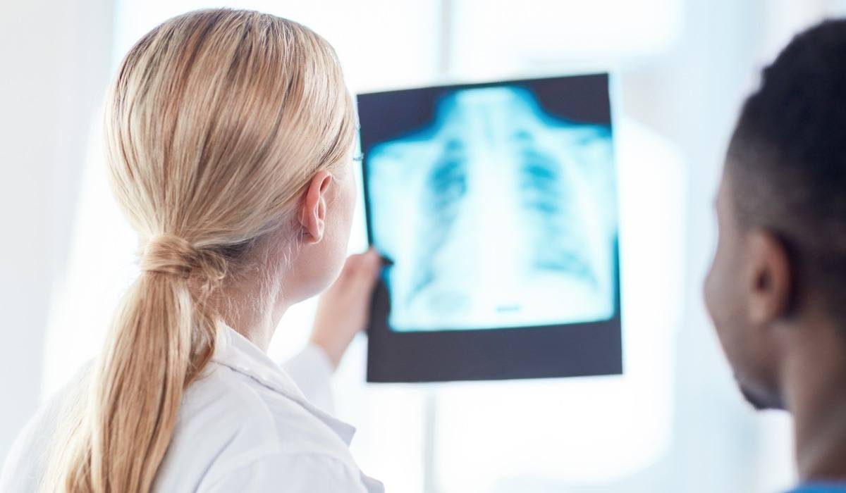 Two people looking at an x-ray scan