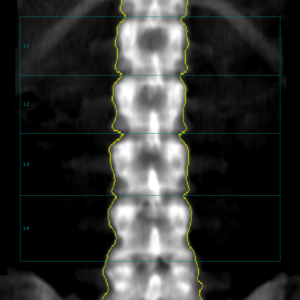 DXA imaging close up