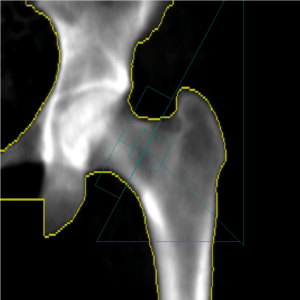 DXA imaging close up