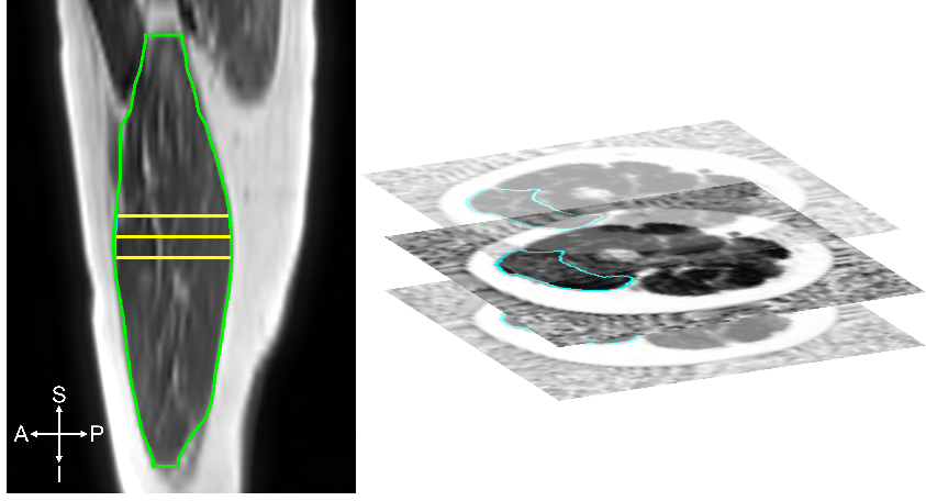 Muscle segmentation on MRI and co-registration with proton density fat fraction map