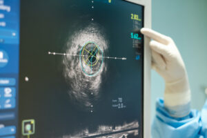 Intravascular ultrasound imaging (IVUS) at cardiac catheterization laboratory room.