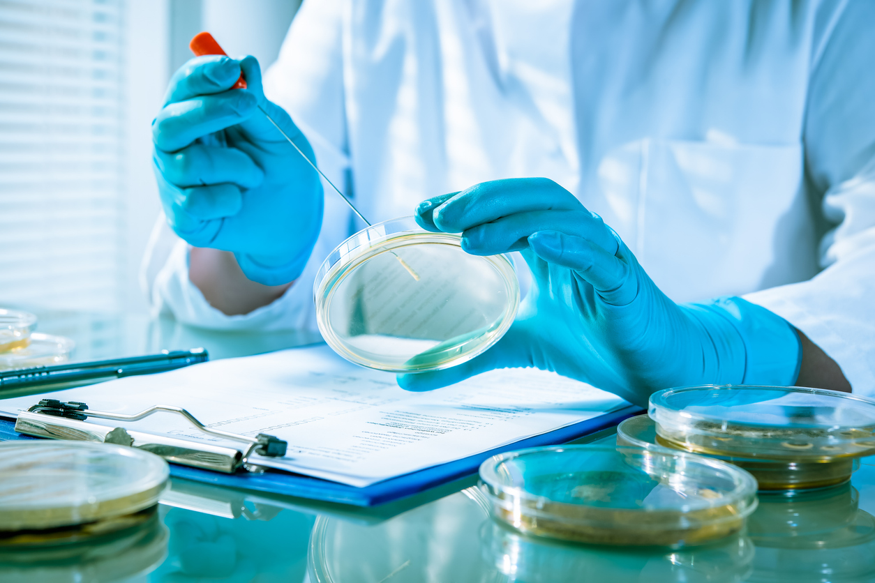 Germs growing on an agar plate in microbiology laboratory